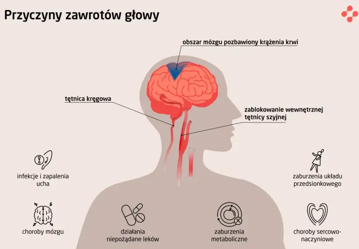 Ilustracja przedstawia przyczyny zawrotów głowy i wymiotów: blokady tętnic, choroby mózgu, infekcje ucha, zaburzenia metaboliczne i sercowo-naczyniowe.