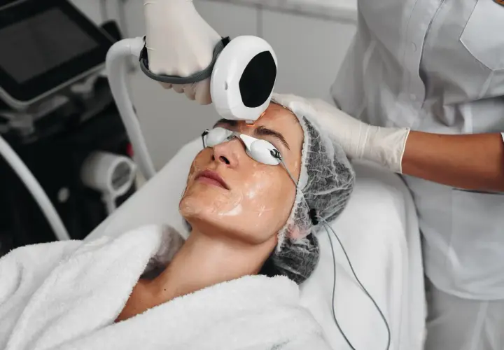 Trattamento estetico per come rimpolpare il viso con laser. Una persona con occhiali protettivi riceve un trattamento sul viso.