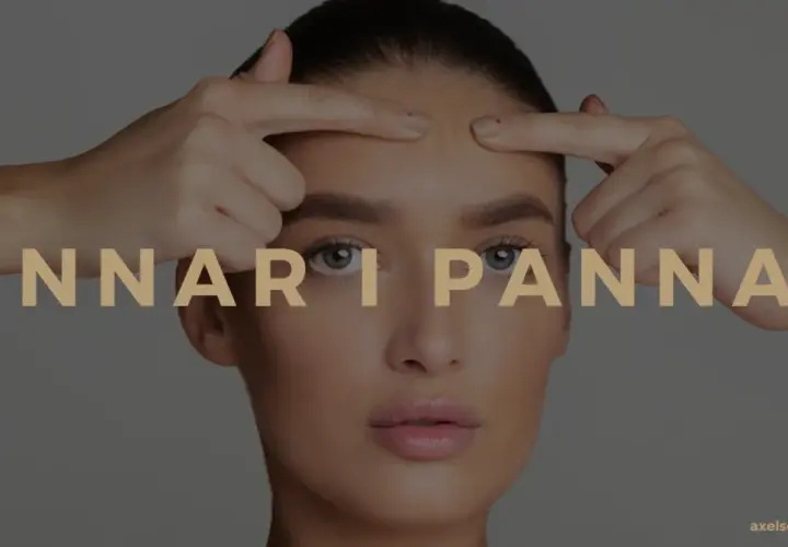 En kvinna undersöker sina finnar i pannan. Texten "FINNAR I PANNAN" syns över bilden.