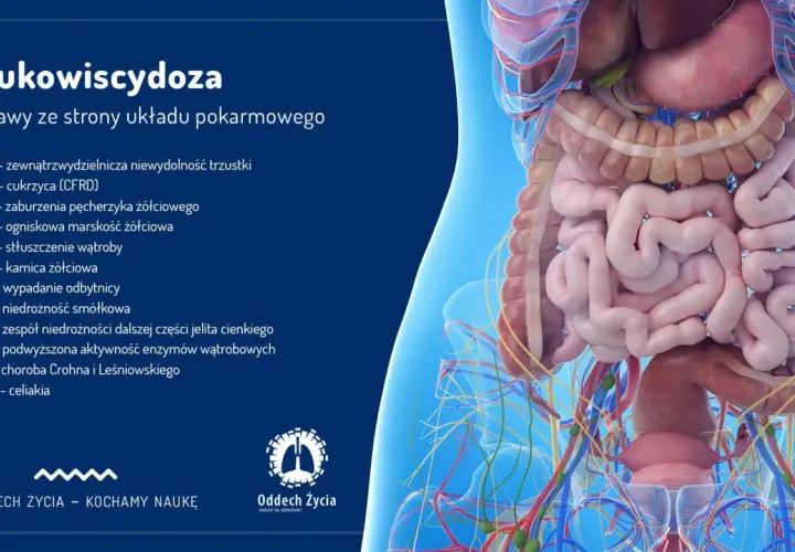 Mukowiscydoza objawy u dorosłego - co musisz wiedzieć, aby pomóc
