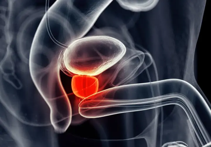 Anatomical illustration showing the bladder and prostate. The prostate is highlighted in red, suggesting inflammation or pain, relevant to understanding masaż prostaty.