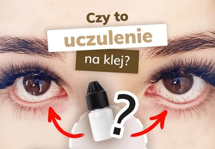 Alergia na klej do rzęs: Objawy, leczenie i co robić krok po kroku