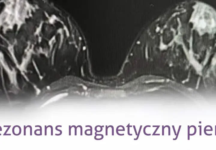 Mammografia czy rezonans - która metoda diagnozy raka piersi jest lepsza?