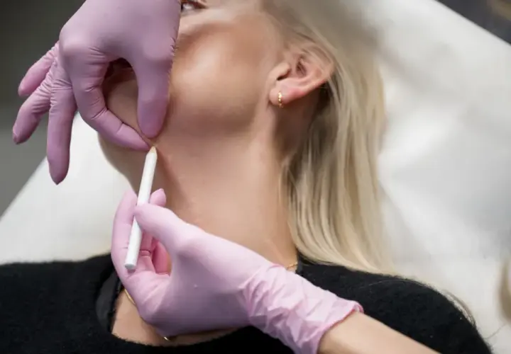 En person får botox i nacken. En hand med rosa handske markerar med en penna på huden.