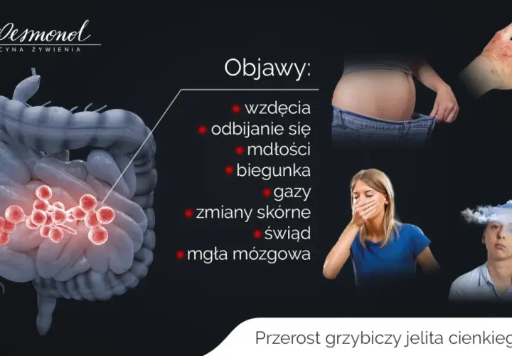 Ilustracja przedstawia jelita z czerwonymi skupiskami, symbolizującymi przerost grzybicy. Wymienione objawy to wzdęcia, mdłości, biegunka, gazy, zmiany skórne, świąd i mgła mózgowa.