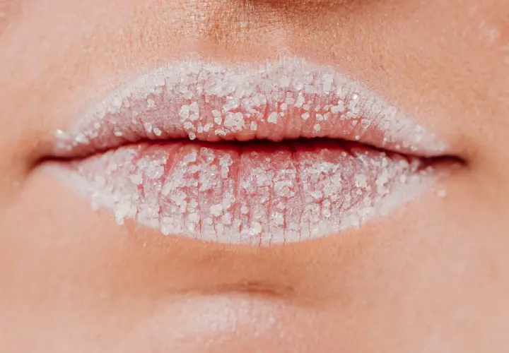 Labios blancos cubiertos de azúcar, posibles causas de sequedad y descamación.