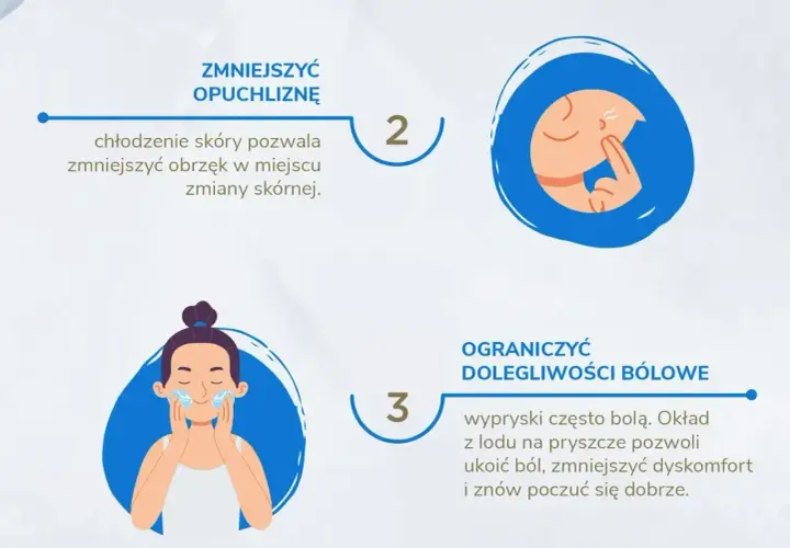 Jak pozbyc sie pryszcza: chłodzenie zmniejsza opuchliznę, a okład z lodu łagodzi ból i dyskomfort.