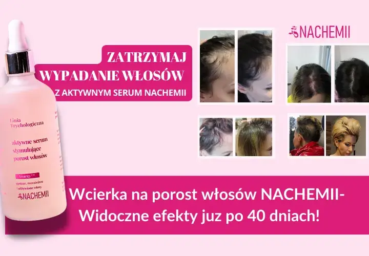 Wcierki do włosów: Czy działają? Składniki, efekty i jak stosować