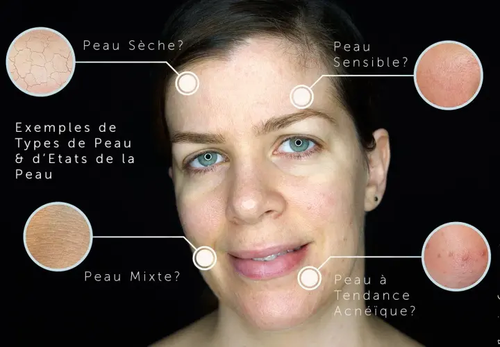 Visage montrant différents types de peau : sèche, sensible, mixte et à tendance acnéique. Comment savoir si on a la peau grasse ?