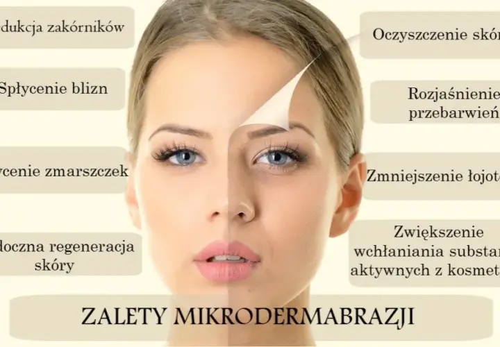 Mikrodermabrazja twarzy: Czy to klucz do Twojej idealnej cery?