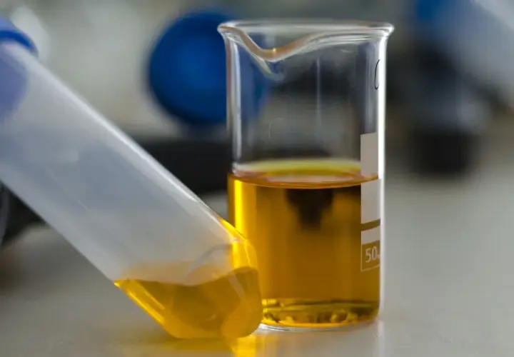 Jak przechowywać mocz przed oddaniem do laboratorium, by uniknąć błędów?