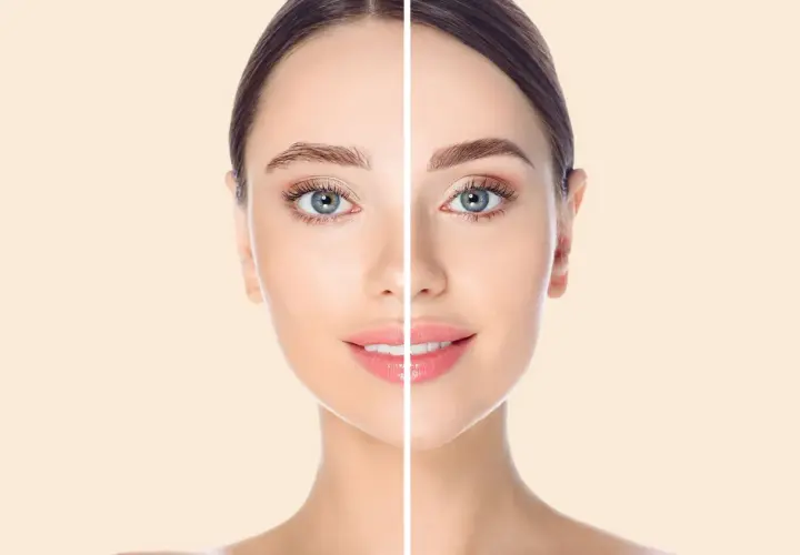 Comparación de cejas: antes, con microblading mal hecho, y después, con cejas perfectas.