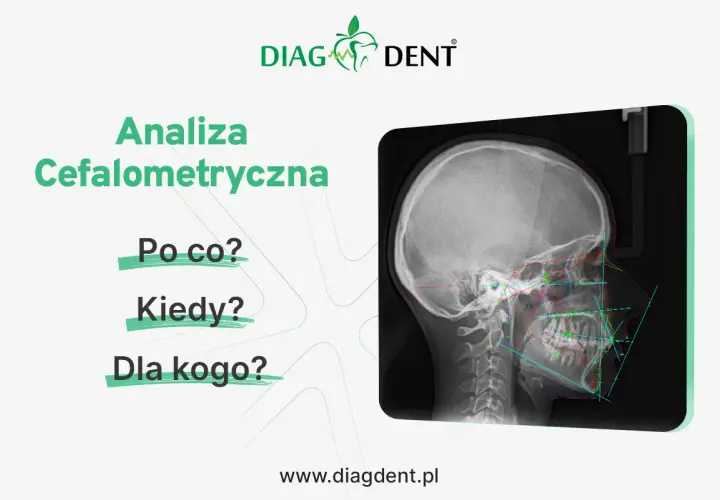 Analiza cefalometryczna: zdjęcie RTG czaszki z naniesionymi liniami i punktami pomiarowymi. Pytania: Po co? Kiedy? Dla kogo?