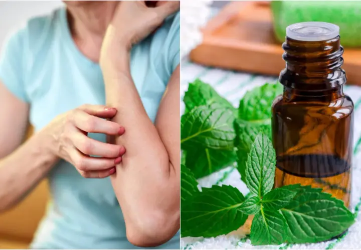 Persona con picazón en el brazo, junto a aceite esencial de menta. Posibles remedios caseros para la alergia a la humedad.