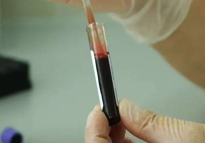 Czy leki na HIV są refundowane? Sprawdź, co musisz wiedzieć o dostępności