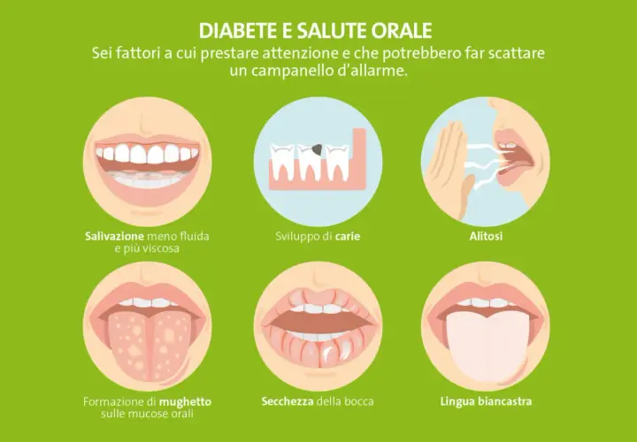 Sei sintomi legati al diabete e alla salute orale: bocca secca, alitosi, mughetto, carie, lingua biancastra e salivazione ridotta.
