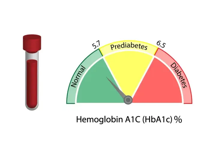 Wskaźnik HBA1C pokazuje poziom cukru we krwi: zielony (norma), żółty (stan przedcukrzycowy), czerwony (cukrzyca). Obok probówka z krwią.