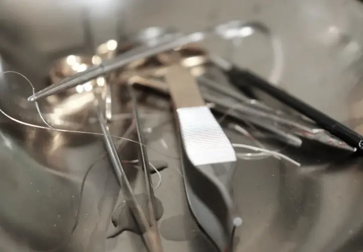 Pinces chirurgicales et fils de suture dans un plateau métallique. Un fil semble détaché, évoquant un point de suture qui a sauté après une circoncision.