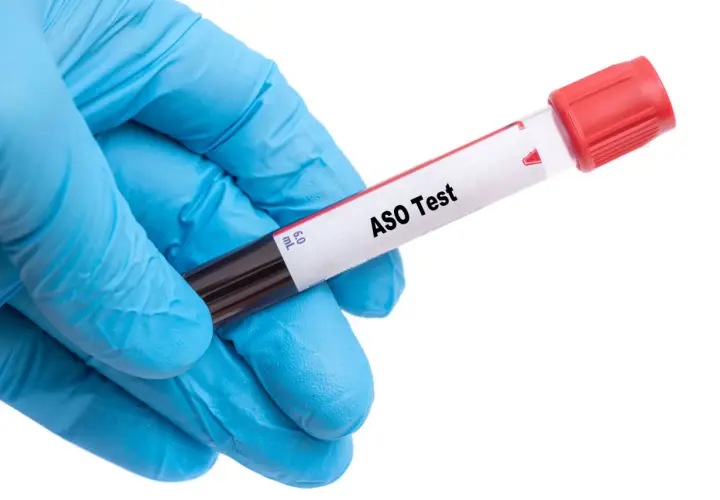 Ręka w niebieskiej rękawiczce trzyma probówkę z napisem "ASO Test".