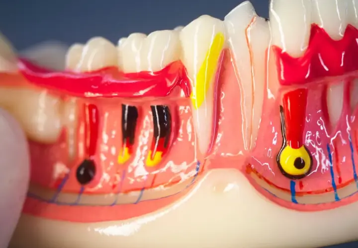 Modello anatomico di denti e gengive, con evidenziati nervi e vasi sanguigni. Si nota il colletto dentale e la struttura ossea.