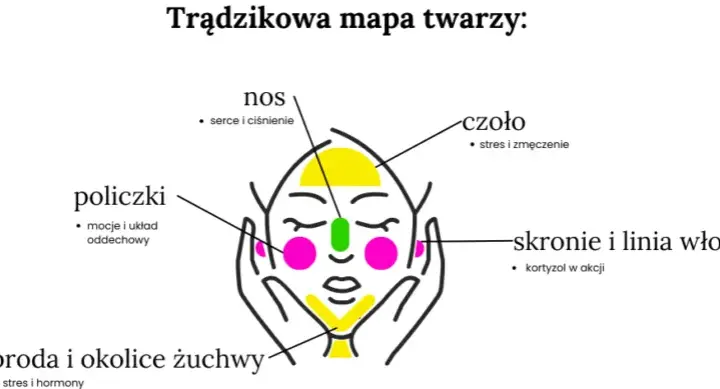 Trądzik młodzieńczy: Twoja mapa drogowa do zdrowej skóry