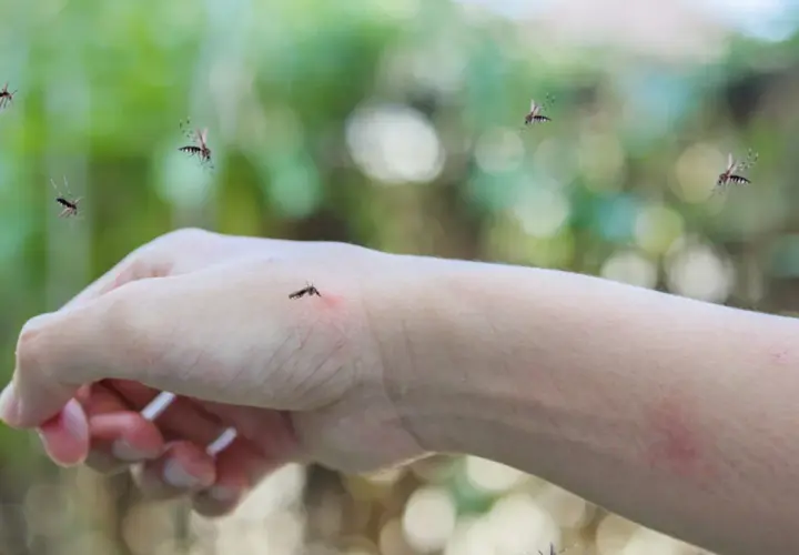 Komary krążą wokół ręki, na której widać zaczerwienienie po ugryzieniu. Szukasz co na ugryzienie komara?