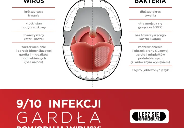 Najczęstsze objawy zapalenia gardła: 7 niepokojących sygnałów choroby