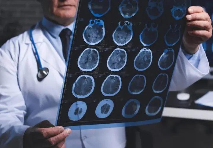Neurolog od czego zacząć? Objawy, które mogą zaskoczyć