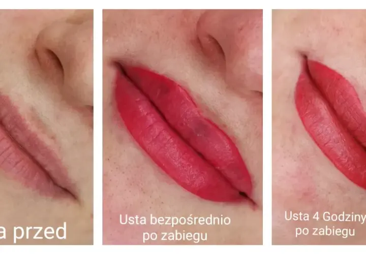 Usta po makijażu permanentnym: przed zabiegiem, tuż po nim i 4 godziny później. Kolor staje się coraz bardziej intensywny.