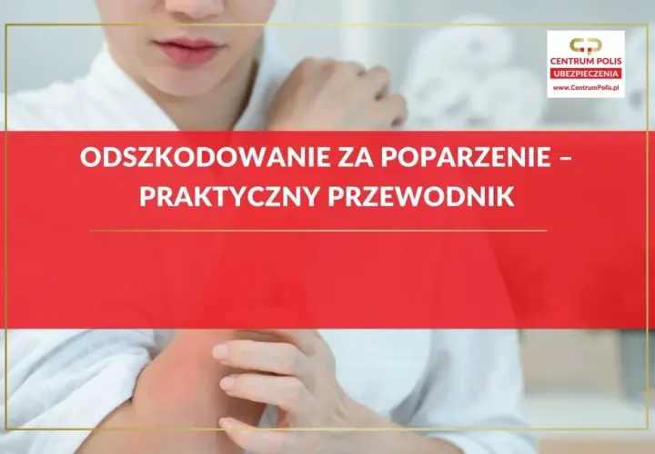 Odszkodowanie za oparzenie – praktyczny przewodnik. Kobieta z zaczerwienionym ramieniem, dotyka bolącego miejsca.