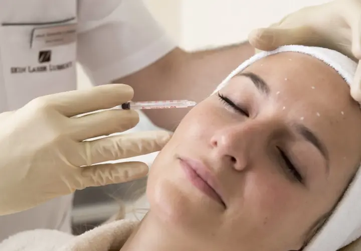 Zabieg z użyciem botoksu: precyzyjne botox miejsca wstrzyknięć na czole i skroniach.