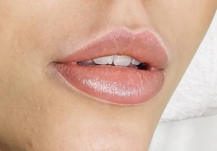 Fylliga läppar med en naturlig rosa ton efter lip blush-behandling. Vackert och fräscht resultat.