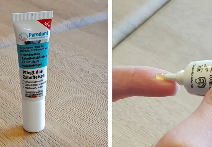 Parodont Zahnfleischpflege-Gel: eine mögliche beste Salbe gegen Zahnfleischentzündung, mit Schwarzkümmelöl.