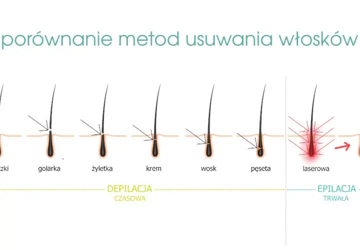 Elektroepilacja: Jedyna trwała depilacja dla każdego włosa?