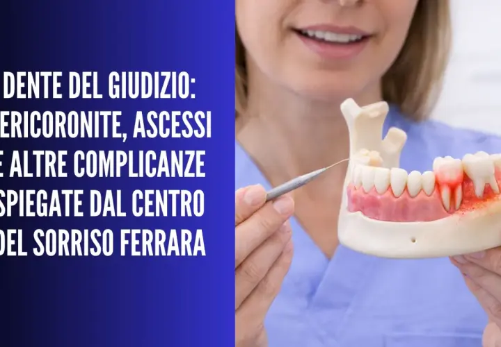 Modello di mascella con dente del giudizio infiammato, che illustra il dolore alla pressione. Dentista spiega complicazioni.