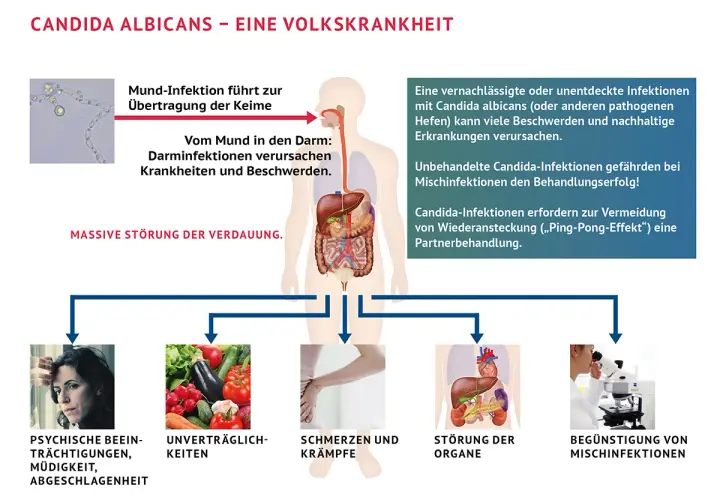 Psychische Belastung, Verdauungsprobleme, Schmerzen, Organstörungen und Mischinfektionen sind Symptome, wenn Candida abstirbt.