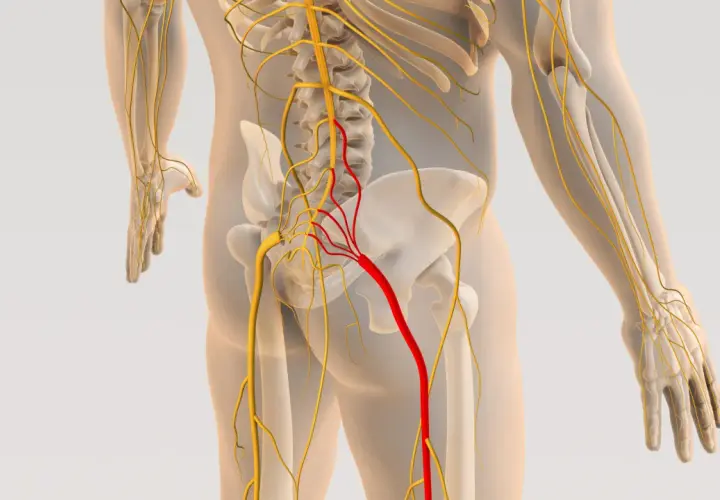 Anatomia układu nerwowego, z uwydatnionym czerwonym nerwem wskazującym na potencjalną przepuklinę kręgosłupa.