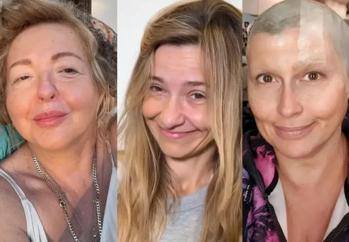 Trzy kobiety w uśmiechu, każda w swoim stylu. Jedna z nich, po chemioterapii, pokazuje siłę. To piękno bez makijażu.
