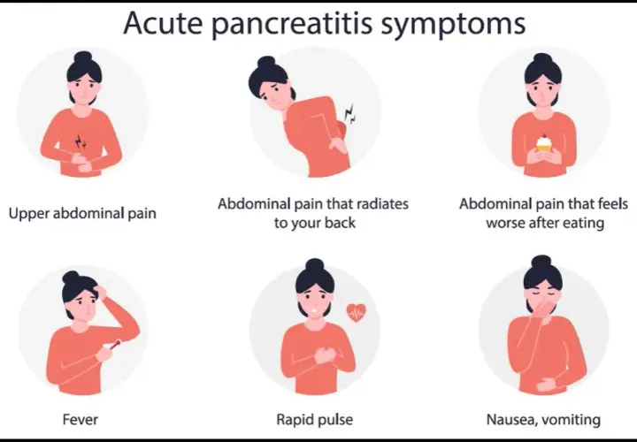 Síntomas pancreatitis leve: ¿Cómo reconocerlos y cuándo actuar?