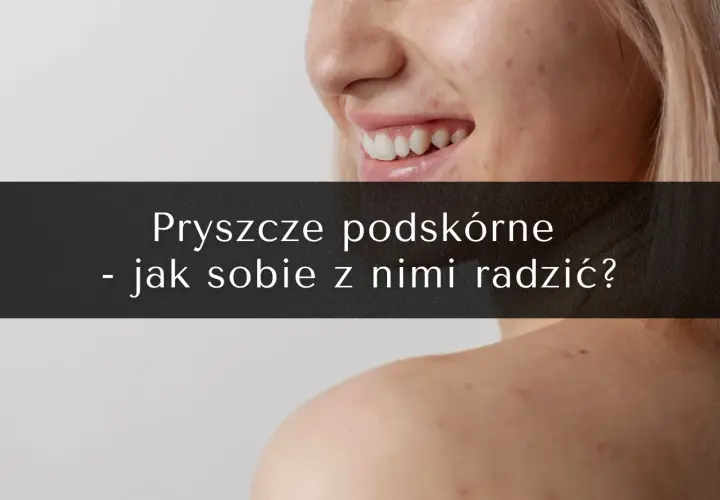 Podskórne pryszcze: Jak się ich pozbyć? Skuteczny plan ekspertki
