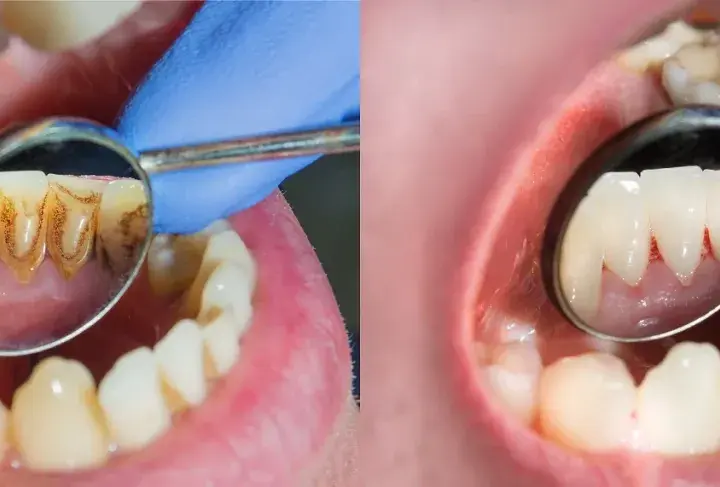 Jak zwracać się do dentysty, aby zyskać jego szacunek i zaufanie