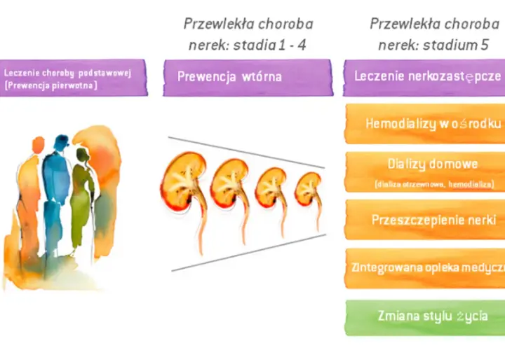 Czy po przeszczepie nerki należy się renta? Sprawdź ważne informacje