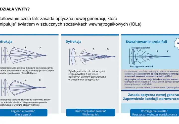 Czym są soczewki jednoogniskowe? Kluczowe informacje i zastosowania