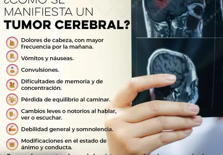 Síntomas de tumor cerebral que no debes ignorar para tu salud