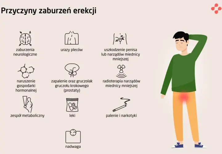Ilustracja przedstawia przyczyny zaburzeń erekcji: problemy neurologiczne, urazy pleców, uszkodzenia penisa, zaburzenia hormonalne, choroby prostaty, radioterapię, zespół metaboliczny, leki, palenie i narkotyki, nadwagę.