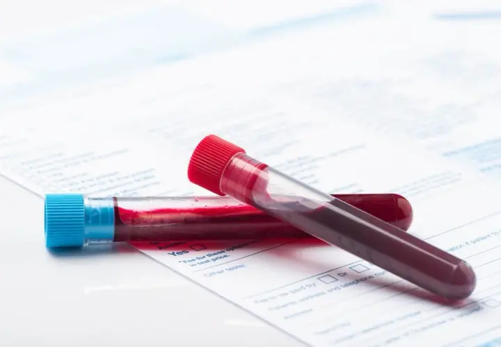 Anemia a psychika: Rozpoznaj objawy, odzyskaj spokój