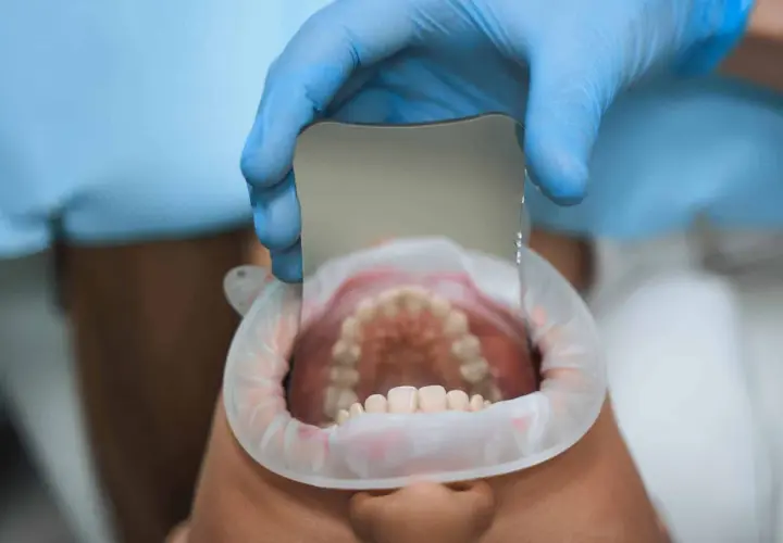 Dentista examina dientes con espejo, detectando una caries leve.