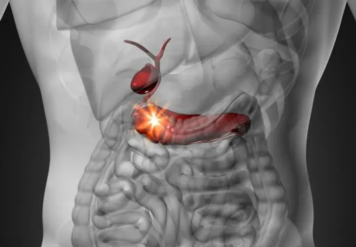 Anatomical illustration of the gallbladder and pancreas, with the pancreas highlighted in red and glowing.