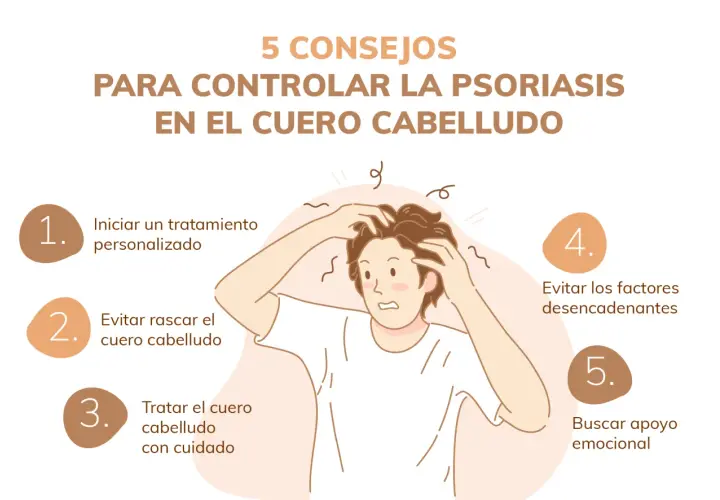 Consejos para controlar la psoriasis en el cuero cabelludo: tratamiento, evitar rascar, cuidado, desencadenantes y apoyo emocional.
