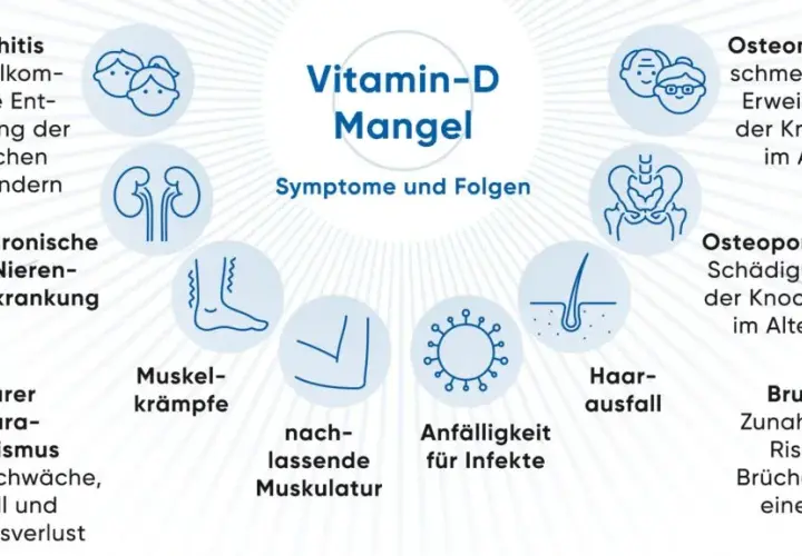 Starker Vitamin D Mangel Symptome: Warnsignale, die Sie beachten sollten